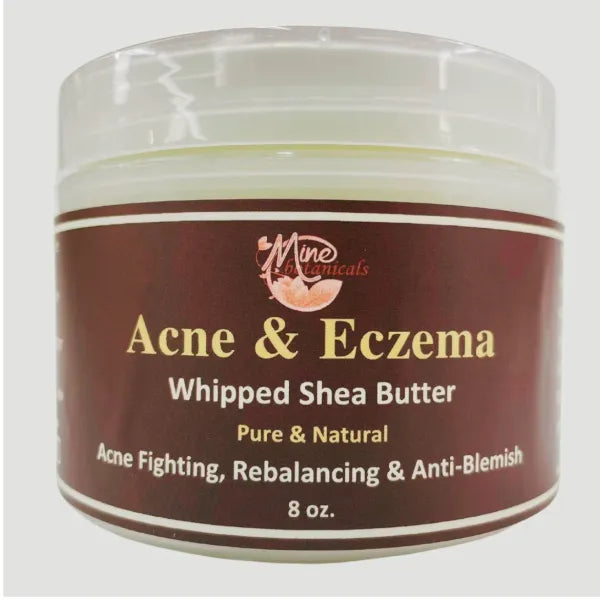 Acne & Eczema Whipped Shea Butter